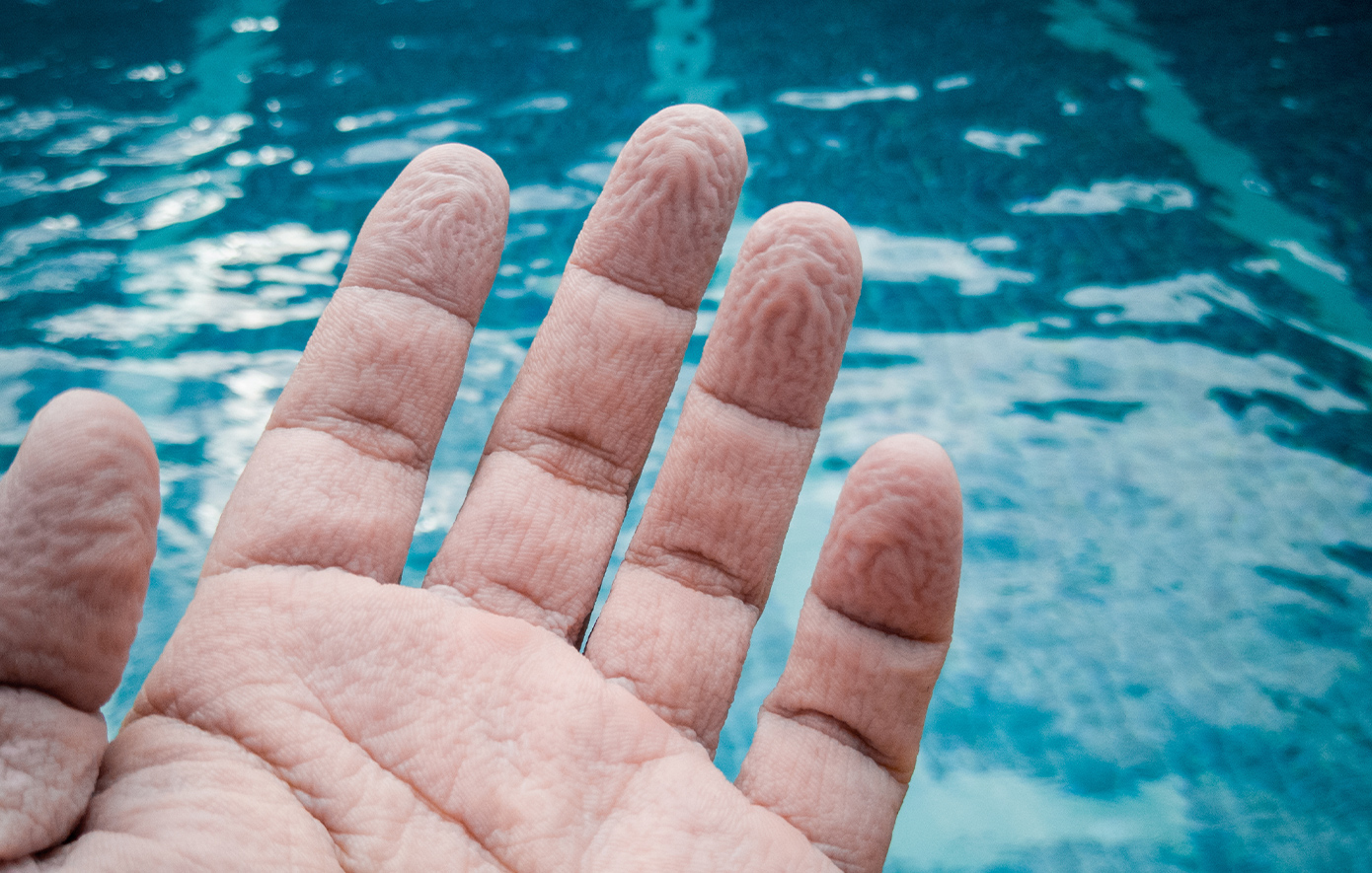 Γιατί ζαρώνουν τα δάχτυλά μας όσο βρίσκονται στο νερό – Ποιες ασθένειες κρύβονται πίσω από το «μειωμένο» ζάρωμα
