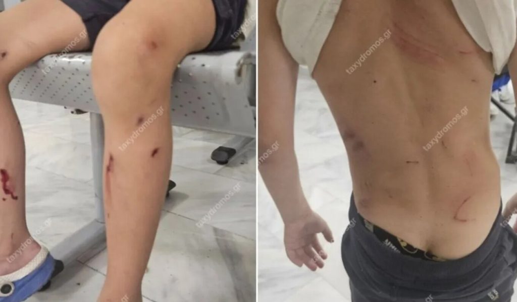 Μητέρα ανήλικου στον Βόλο: «Από θαύμα σώθηκε – Θα τον κατασπάραζαν τα αδέσποτα σκυλιά»