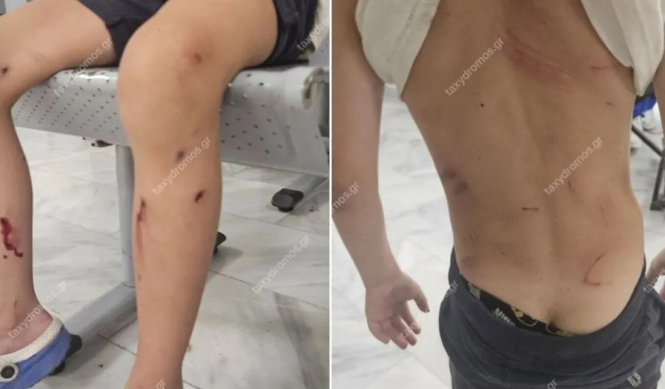 Μητέρα ανήλικου στον Βόλο: «Από θαύμα σώθηκε – Θα τον κατασπάραζαν τα αδέσποτα σκυλιά»