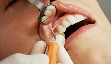 Αυτό το γνωρίζατε; – Γιατί οι Ρωμαίοι είχαν πιο υγιή δόντια από εμάς σήμερα;