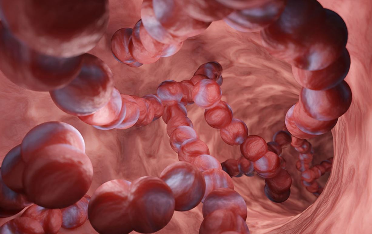 Όσα πρέπει να γνωρίζετε για τον στρεπτόκοκκο: Ποια τα συμπτώματα και η θεραπεία