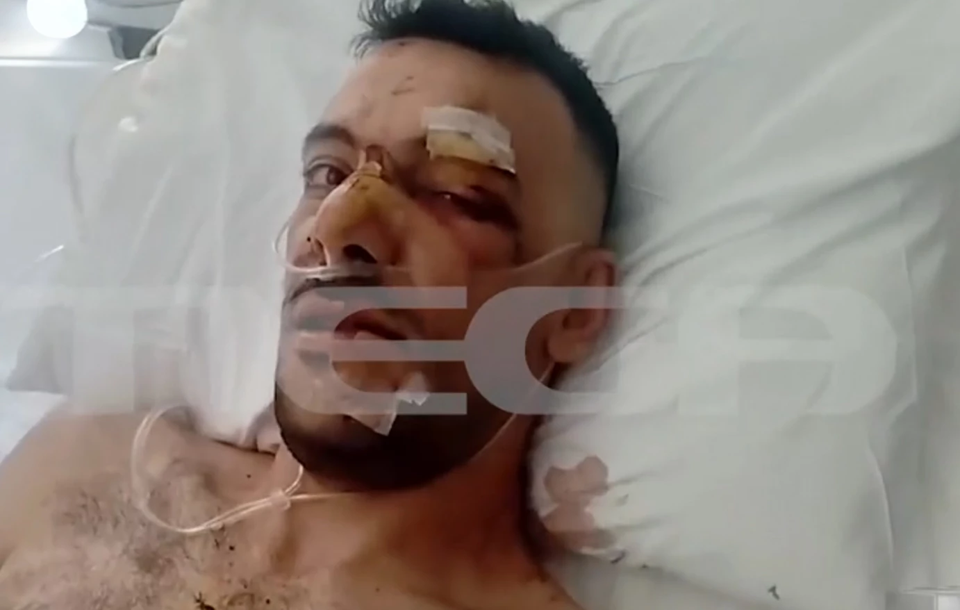 Μυτιλήνη: Στη φυλακή ο 32χρονος για την επίθεση με μαχαίρι σε 35χρονο σε πανηγύρι