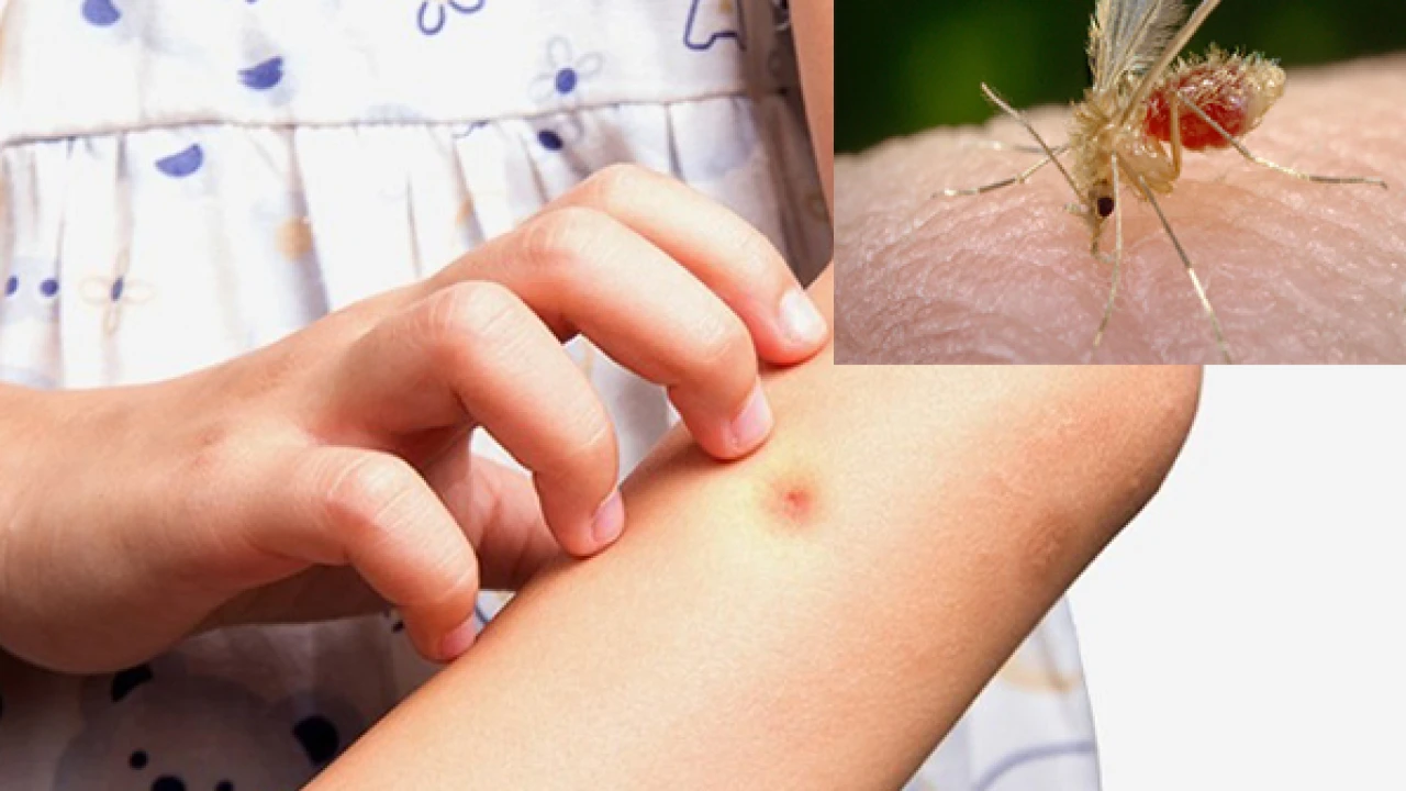 Δείτε ποια χρώματα πρέπει να φοράτε για να μην σας τσιμπούν κουνούπια