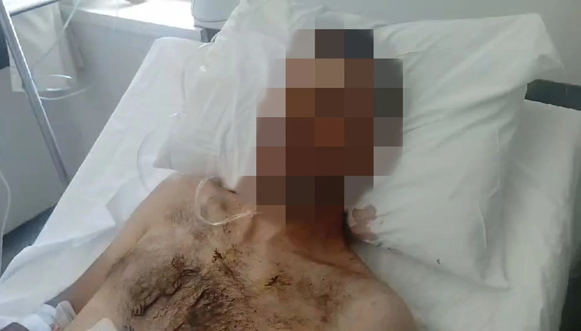 Λέσβος: Στη φυλακή ο 32χρονος για την αιματηρή επίθεση στο πανηγύρι – Τι λέει ο πατέρας του θύματος που μαχαιρώθηκε