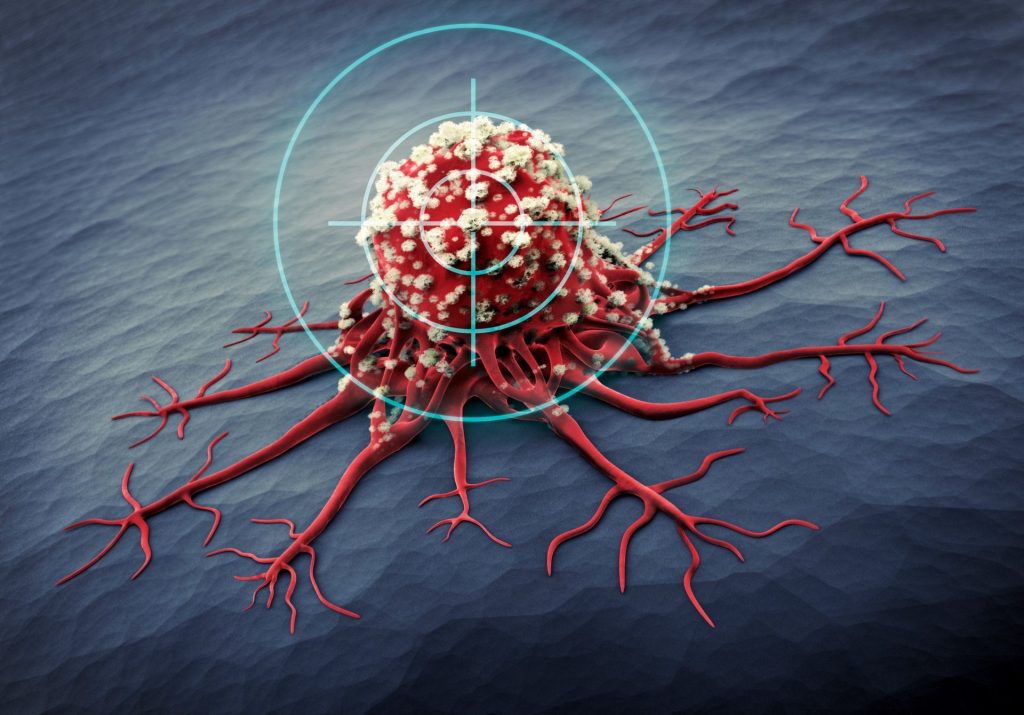 Μελέτη: Η ακτινοθεραπεία για την αντιμετώπιση του καρκίνου αυξάνει τον κίνδυνο που κρύβουν άλλοι κακοήθεις όγκοι