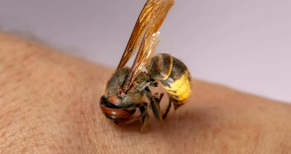 Τσίμπημα μέλισσας: Τα βήματα που πρέπει να κάνετε για να το αντιμετωπίσετε