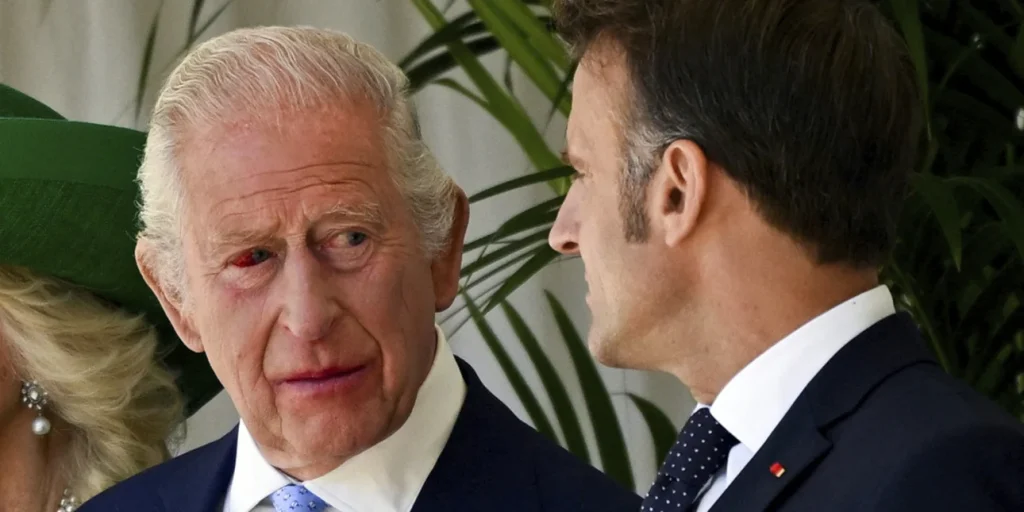 Βασιλιάς Κάρολος: Εμφανίστηκε με κατακόκκινο μάτι – Η εξήγηση του Παλατιού 