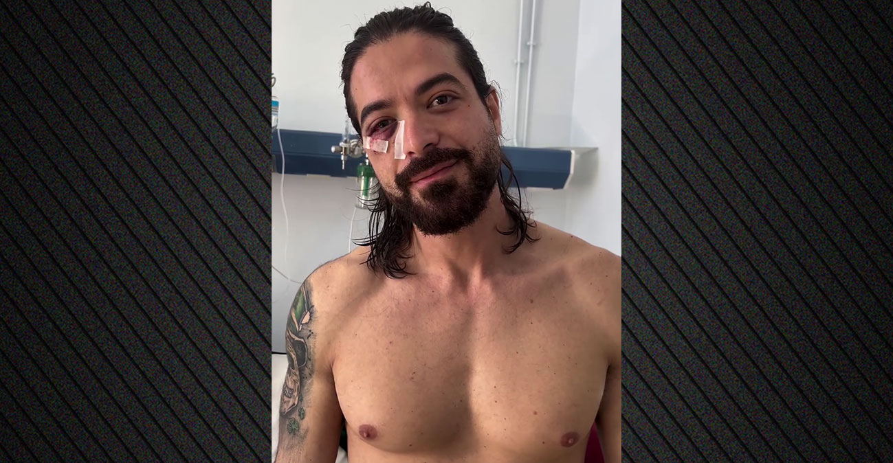 Άρης Μουγκοπέτρος: Αφαιρέθηκαν τα καρφιά από τον αντίχειρά του, τρεις μήνες μετά τον τραυματισμό (φωτο)