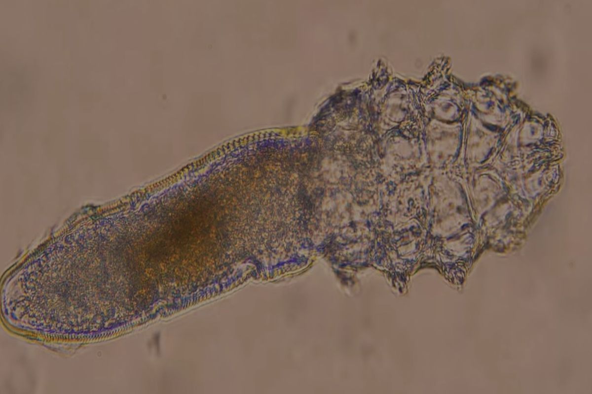 Το γνωρίζατε; – Aυτά είναι τα προβλήματα που μπορεί να σας δημιουργήσουν στα μάτια τα ακάρεα βλεφαρίδας