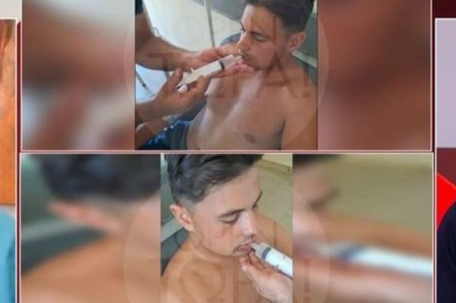 Βόνιτσα: Ομάδα 15 ατόμων ξυλοκόπησαν άγρια έναν 18χρονο – Του έσπασαν το σαγόνι και τρώει με σύριγγα (vid)