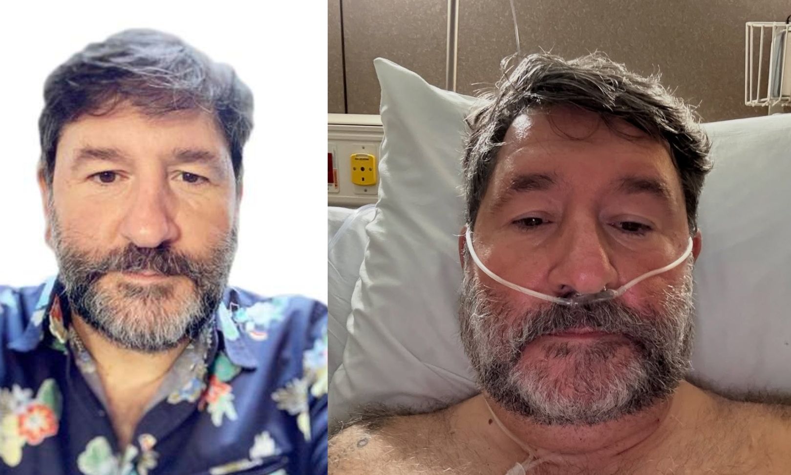 «Σταματήστε το κάπνισμα»: Η μάχη του πρώην παίκτη του MasterChef Γιάννη Μπουροδήμου με τον καρκίνο (φώτο)