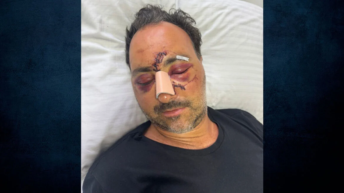 Ελεύθεροι με περιοριστικούς όρους οι δύο κατηγορούμενοι για τον ξυλοδαρμό του Ελληνοκαναδού στο Ηράκλειο το 2024