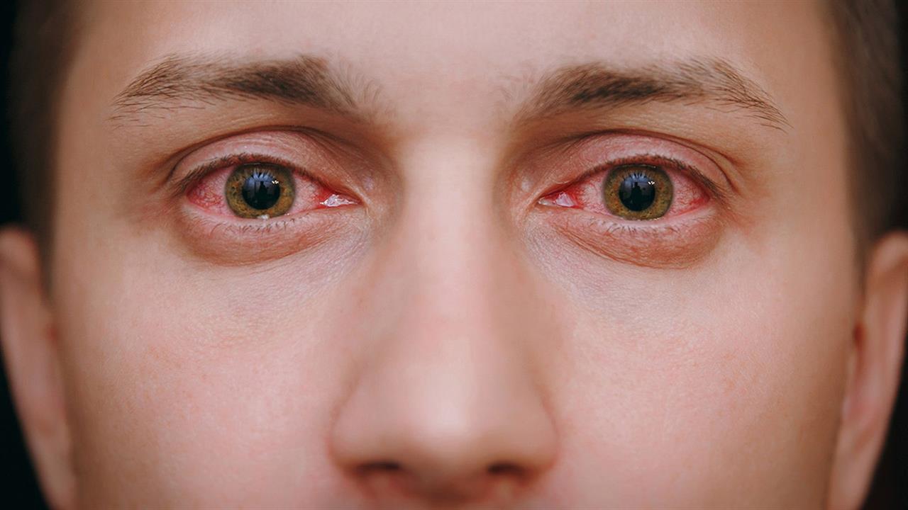 Δείτε τι πρέπει να κάνετε αν μπει καπνός από φωτιά στα μάτια σας