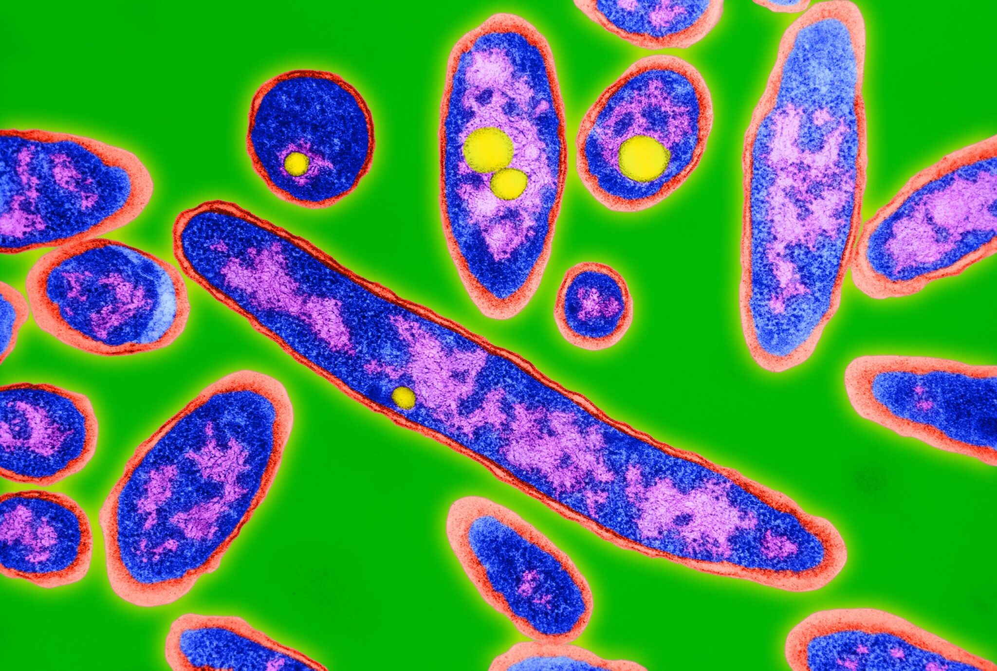 ΗΠΑ: Πέντε νεκροί στο Χάρλεμ από τη νόσο των Λεγεωνάριων