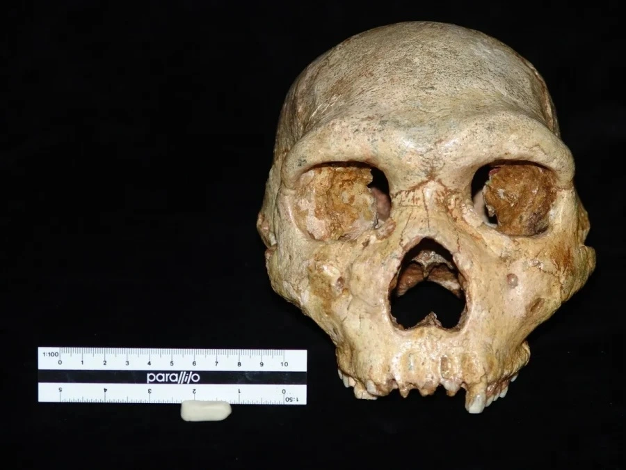 Επιστήμονες χρονολόγησαν το κρανίο του Αρχανθρώπου των Πετραλώνων: «Δεν ανήκει στο είδος μας»