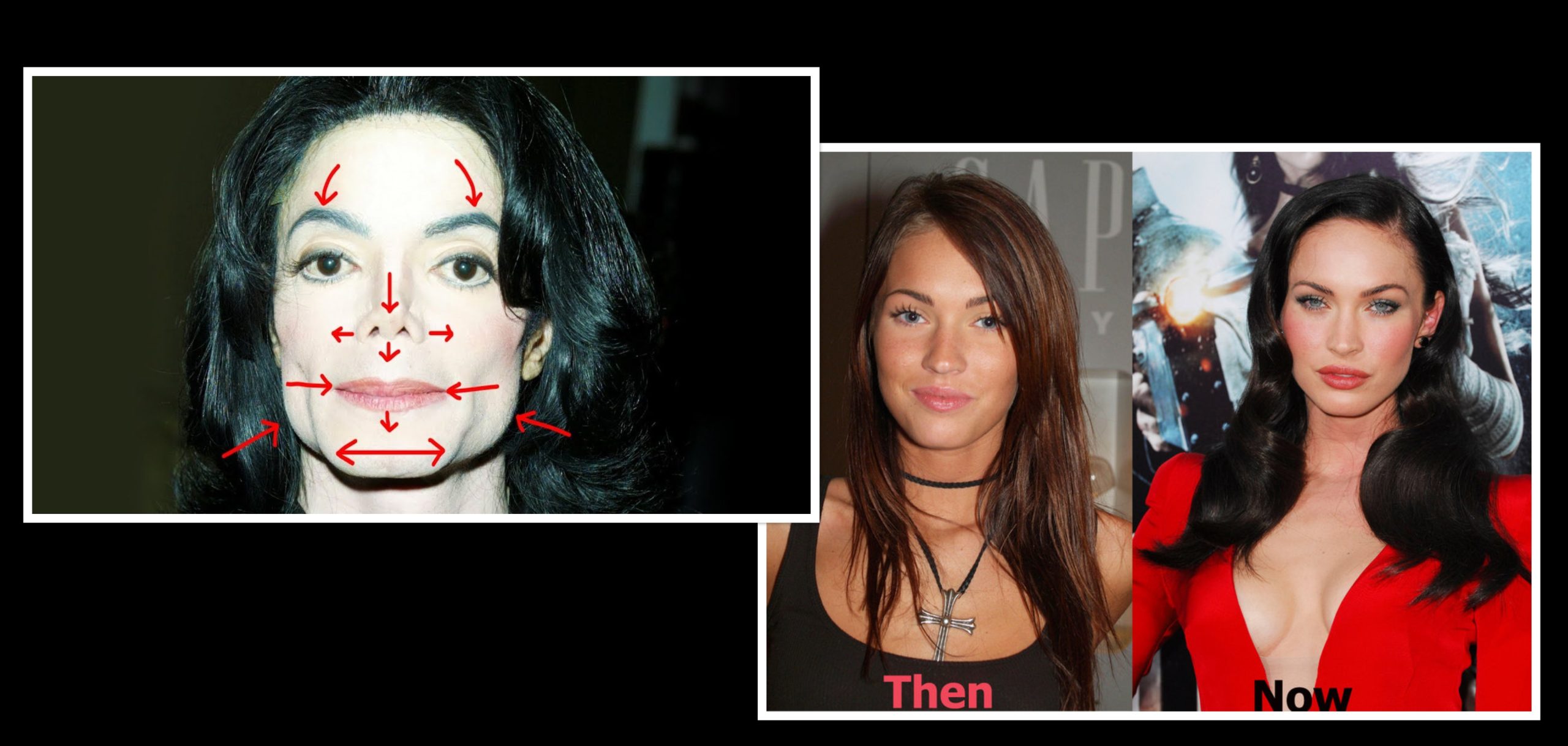 Πλαστικές επεμβάσεις που άλλαξαν τελείως γνωστούς ηθοποιούς