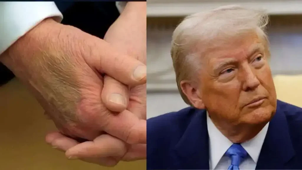 Η απάντηση του Ν.Τραμπ για την διαδικτυακή φημολογία σχετικά με την υγεία του – «Ποτέ δεν ήμουν καλύτερα!»