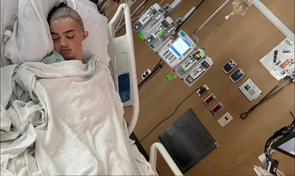 14χρονος στο Τέξας έκανε 60 ράμματα και υποβλήθηκε σε μερική αφαίρεση του κρανίου του μετά από επίθεση που δέχτηκε