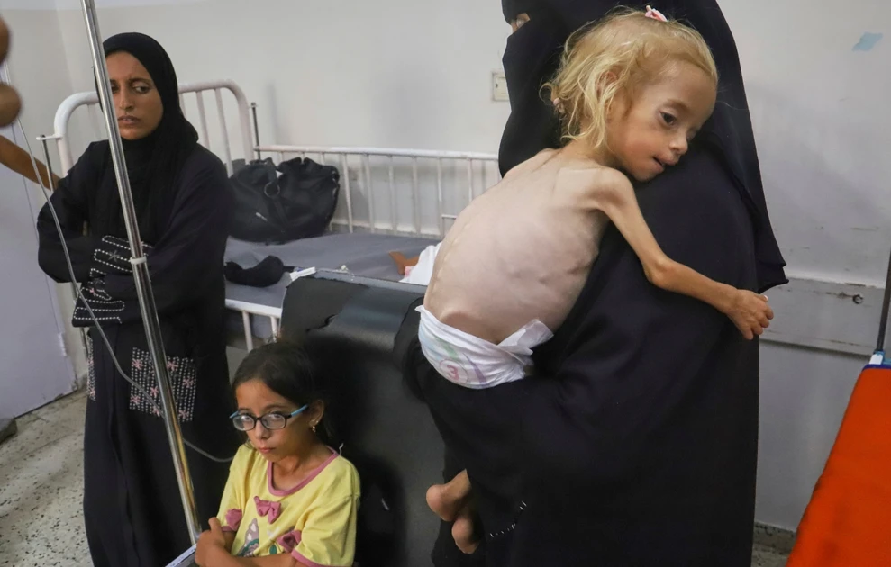 Εικόνες που συγκλονίζουν: Αποστεωμένο κοριτσάκι από τη Γάζα βρίσκει τη δύναμη και χαμογελά – Δείτε φωτογραφίες