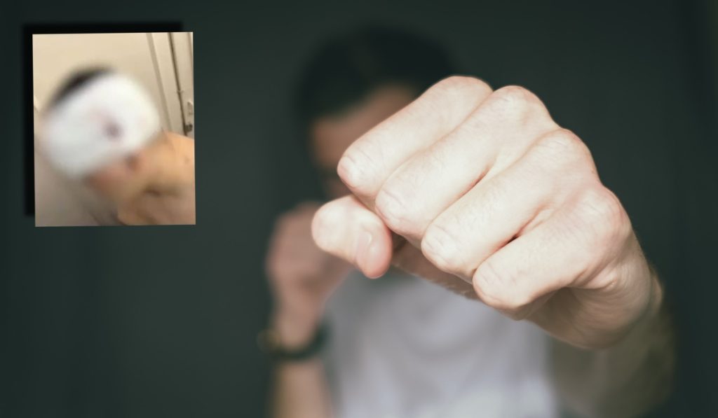 Θεσσαλονίκη: Για απόπειρα ανθρωποκτονίας κατηγορείται ο 18χρονος που ξυλοκόπησε 13χρονο