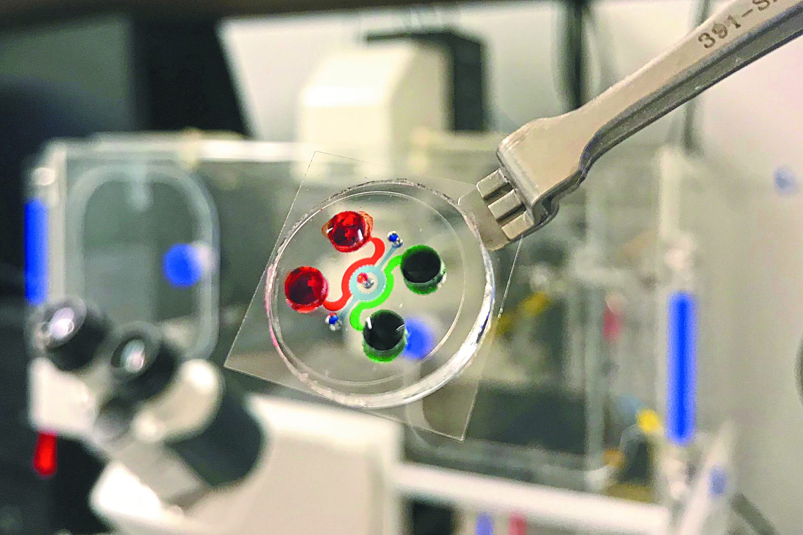 Μικροτσίπ για την πρόληψη της λευχαιμίας – Η επαναστατική μέθοδος για τις θεραπείες CAR-T