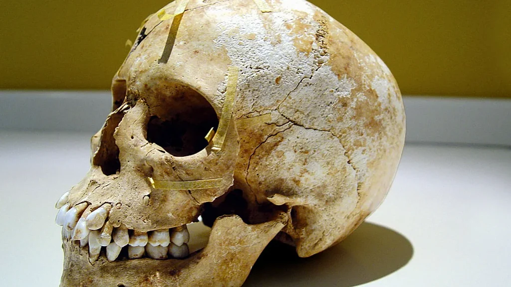 Ερευνητές ανακάλυψαν μετά από 100 χρόνια την πραγματική «ταυτότητα» κρανίου 350 ετών που εντοπίστηκε στη Βολιβία