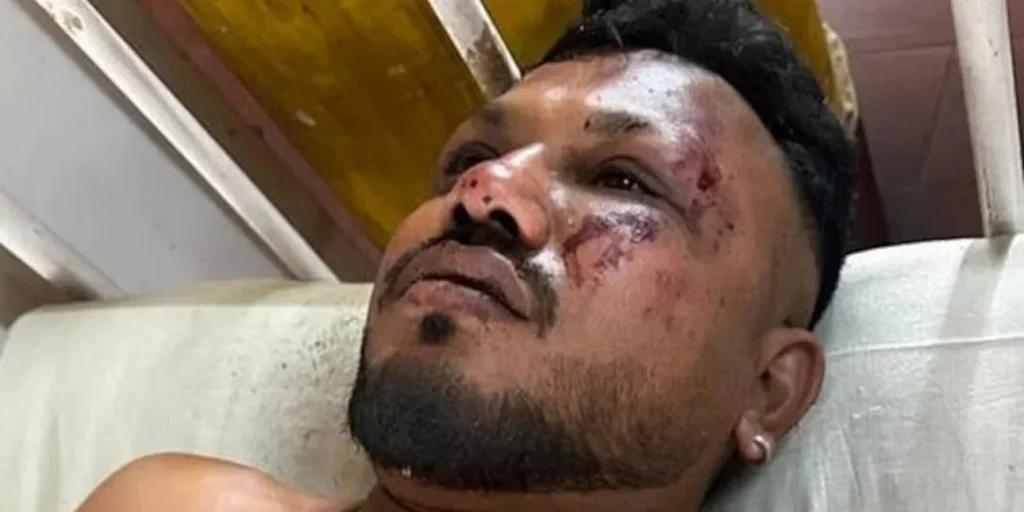 Αεροπορικό δυστύχημα της Air India: Ο μοναδικός επιζών ίσως να μην επιστρέψει ποτέ στο σπίτι του στο Λονδίνο