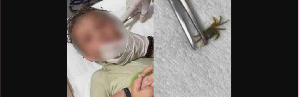 Απίστευτο περιστατικό στο Μεξικό: Γιατροί έβγαλαν ζωντανό καβούρι από το αυτί αγοριού (βίντεο)