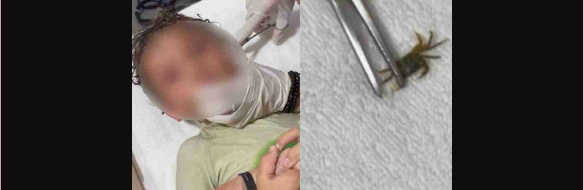 Απίστευτο περιστατικό στο Μεξικό: Γιατροί έβγαλαν ζωντανό καβούρι από το αυτί αγοριού (βίντεο)