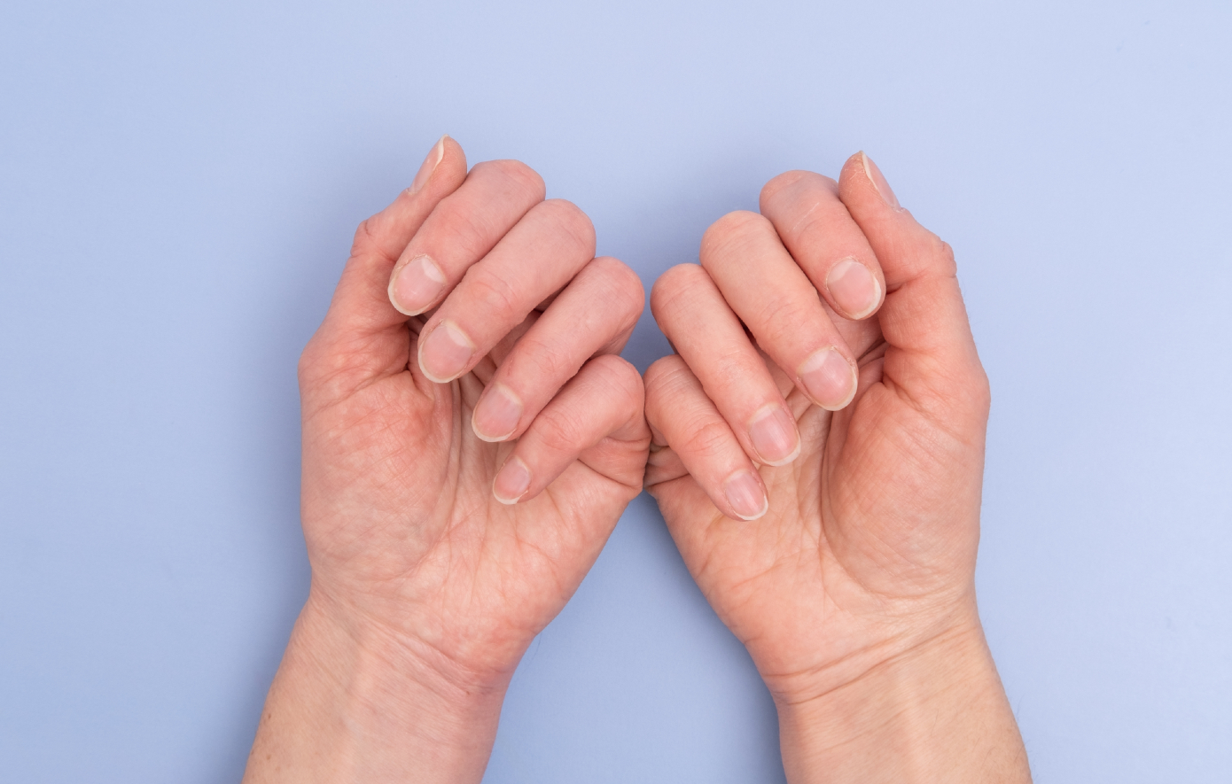 Αυτό είναι το σημάδι στα νύχια που δεν πρέπει να αγνοήσετε
