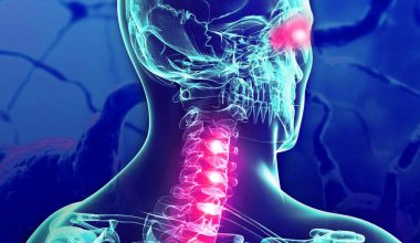 Σκλήρυνση κατά πλάκας: Δείτε ποια είναι τα πρώιμα συμπτώματα που δεν πρέπει να αγνοήσετε