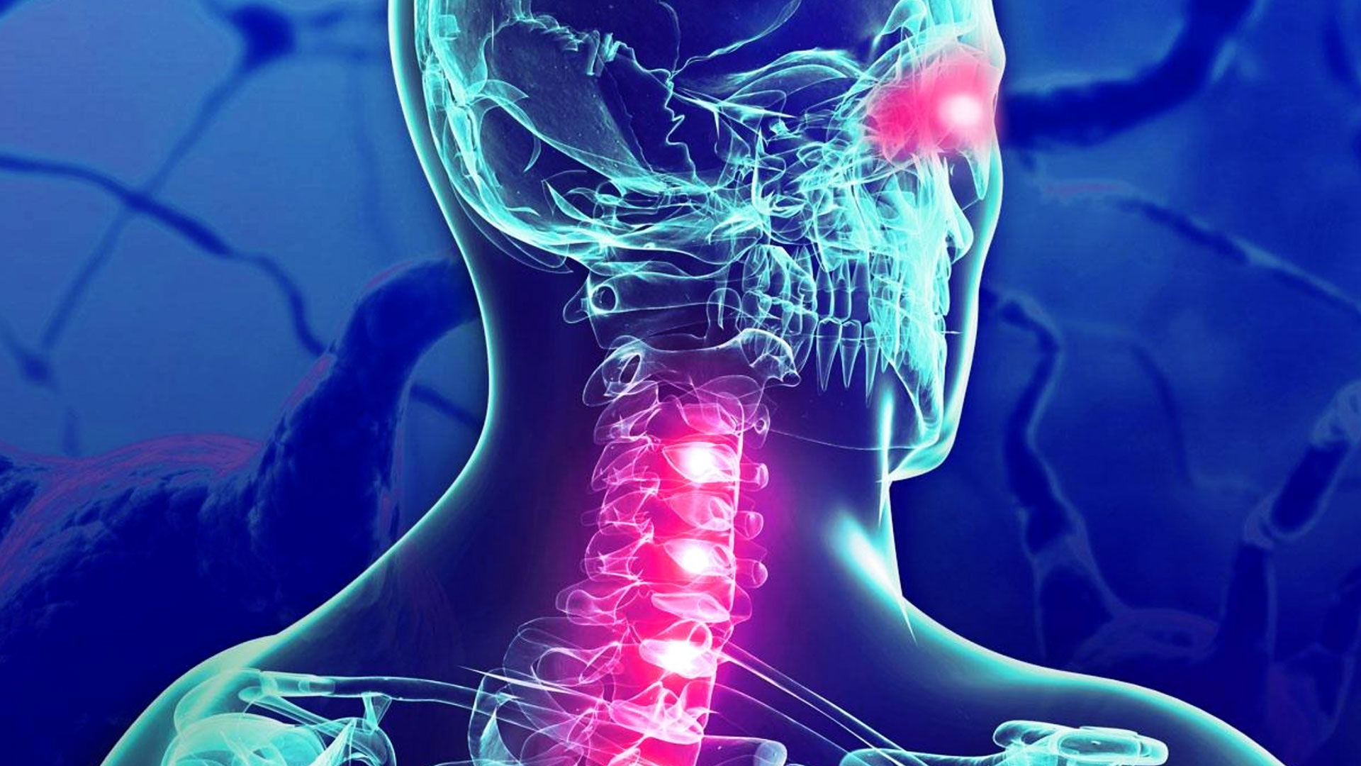 Σκλήρυνση κατά πλάκας: Δείτε ποια είναι τα πρώιμα συμπτώματα που δεν πρέπει να αγνοήσετε