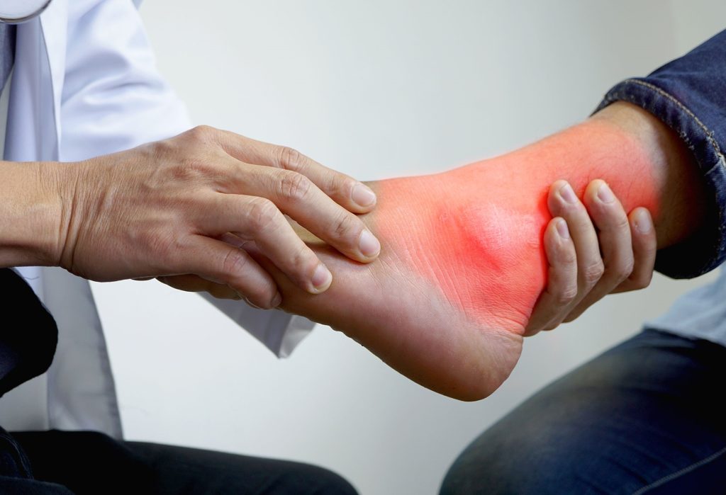 Διάστρεμμα αστραγάλου: Τι να κάνετε για να το αντιμετωπίσετε και ποια τα συμπτώματα