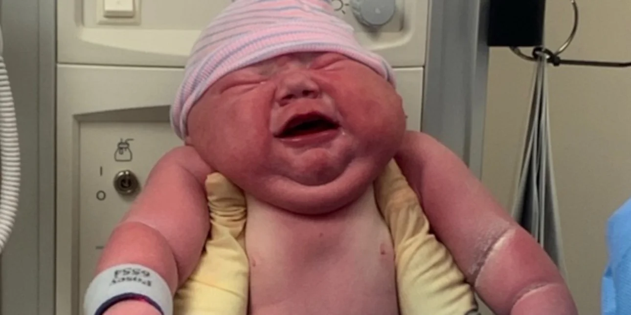 ΗΠΑ: Γυναίκα γέννησε μωρό που ζύγιζε 5,8 κιλά! – Δείτε βίντεο