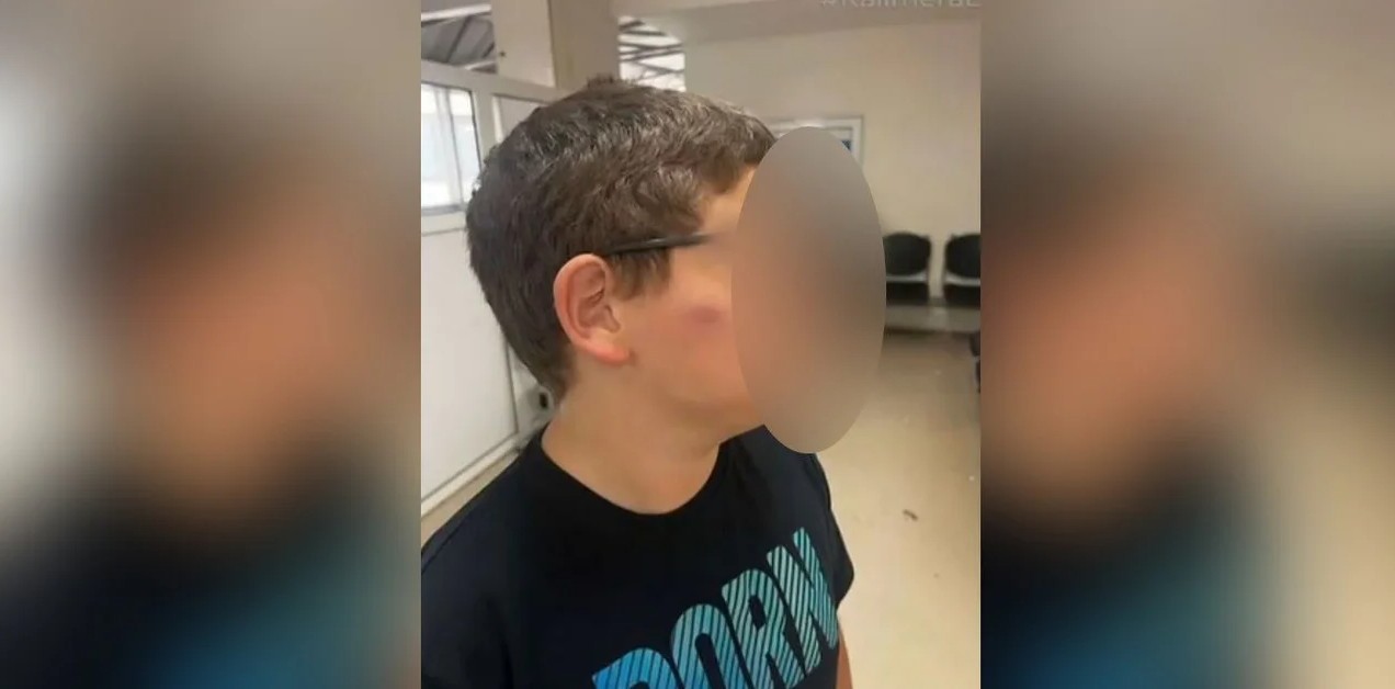 Μητέρα 11χρονου στη Θεσσαλονίκη: «Η διευθύντρια μου είπε να του μάθω να μην δίνει σημασία στο bullying» (βίντεο)