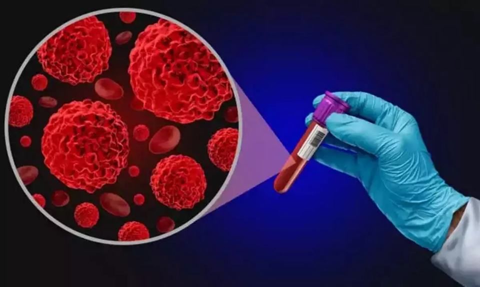 Νέα μελέτη: Η εξέταση αίματος που ανιχνεύει περισσότερους από 50 τύπους καρκίνου