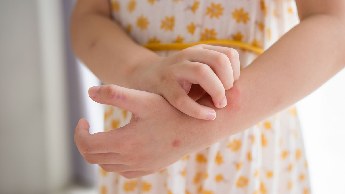 Αυτές είναι οι επτά πιο σπάνιες αλλεργίες στον κόσμο: Τι τις προκαλεί και πώς αντιμετωπίζονται