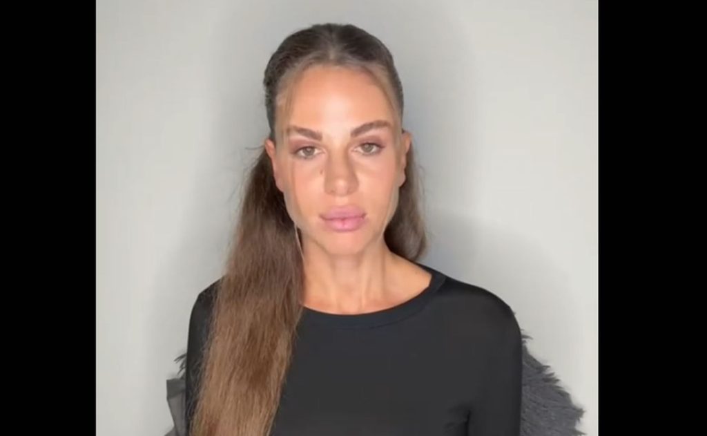 Σε διαθεσιμότητα ο 34χρονος αστυνομικός που ξυλοκόπησε άγρια την πρώην σύντροφό του στα μπουζούκια