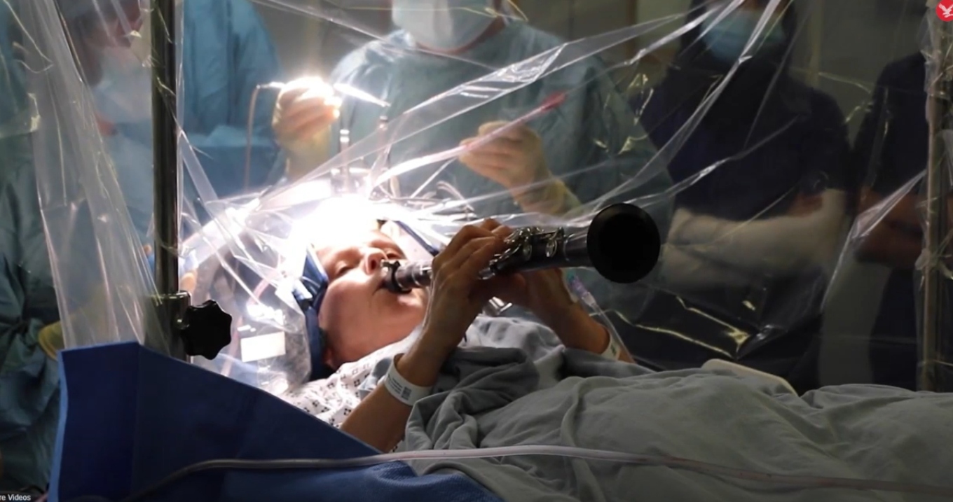 Γυναίκα στη Βρετανία έπαιζε το κλαρινέτο της κατά τη διάρκεια χειρουργείου για την νόσο Πάρκινσον! (βίντεο)