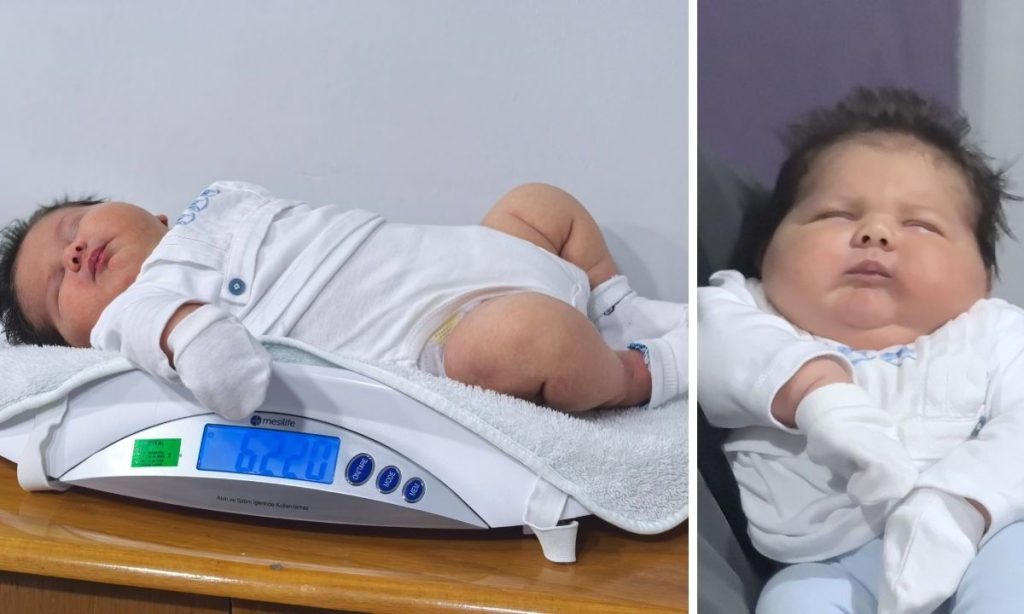 Μωρό-γίγας στην Τουρκία: Γεννήθηκε 6 κιλά και 150 γραμμάρια και ύψος 59 εκατοστά