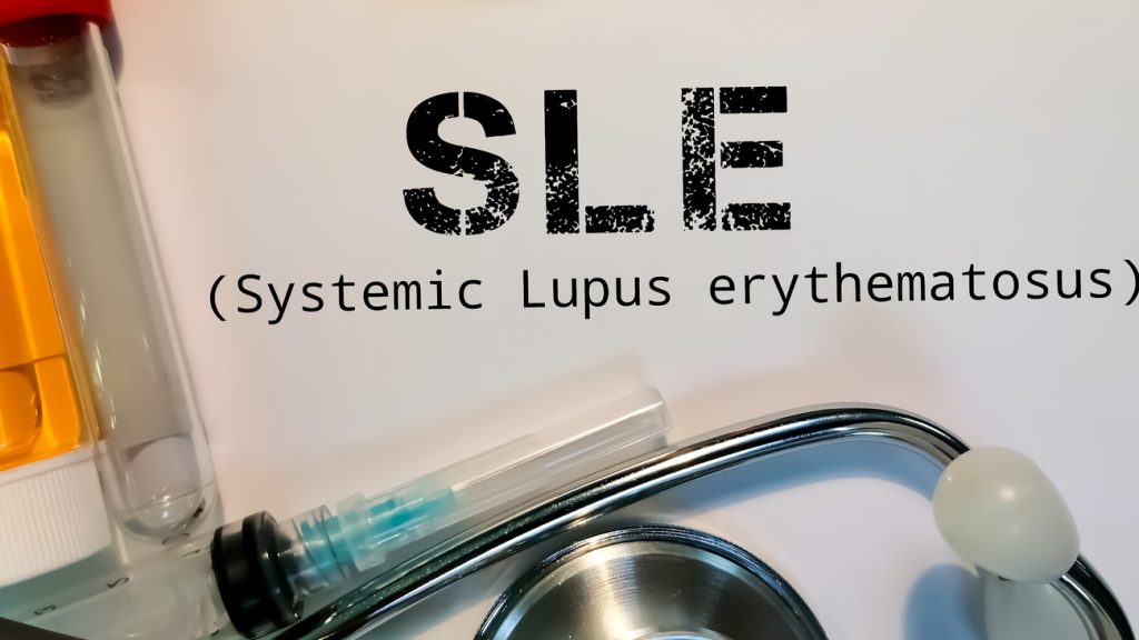 Ερυθηματώδης Λύκος: Αυτά είναι τα πρώιμα συμπτώματα – Σε ποιες ηλικίες εκδηλώνονται