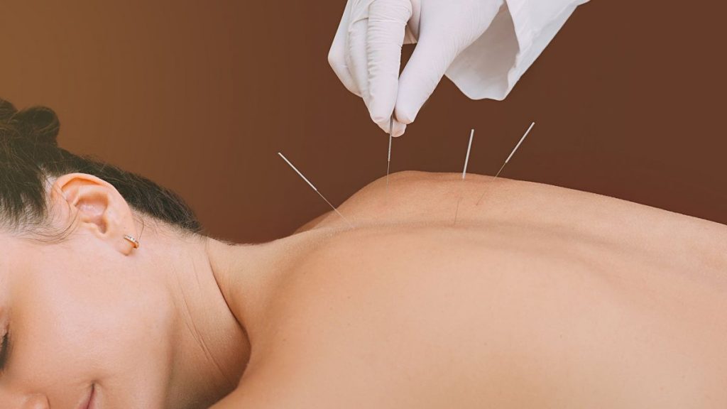 Όσα πρέπει να γνωρίζετε για τον βελονισμό: Ποια τα οφέλη του για την υγεία