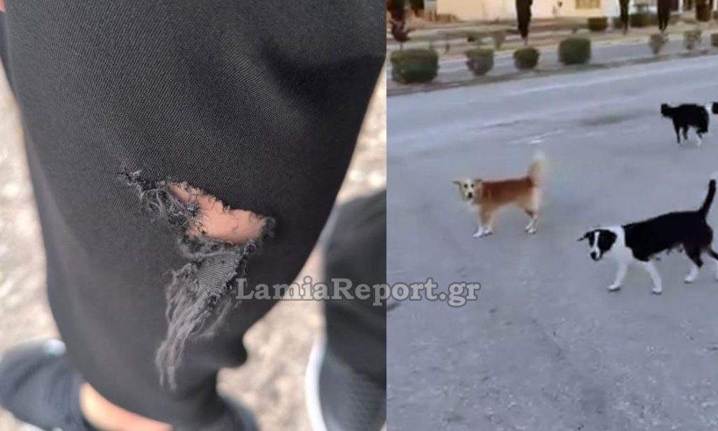 Λαμία: Αγέλη αδέσποτων σκυλιών επιτέθηκε σε περαστικό δαγκώνοντάς τον στο πόδι (φωτο)