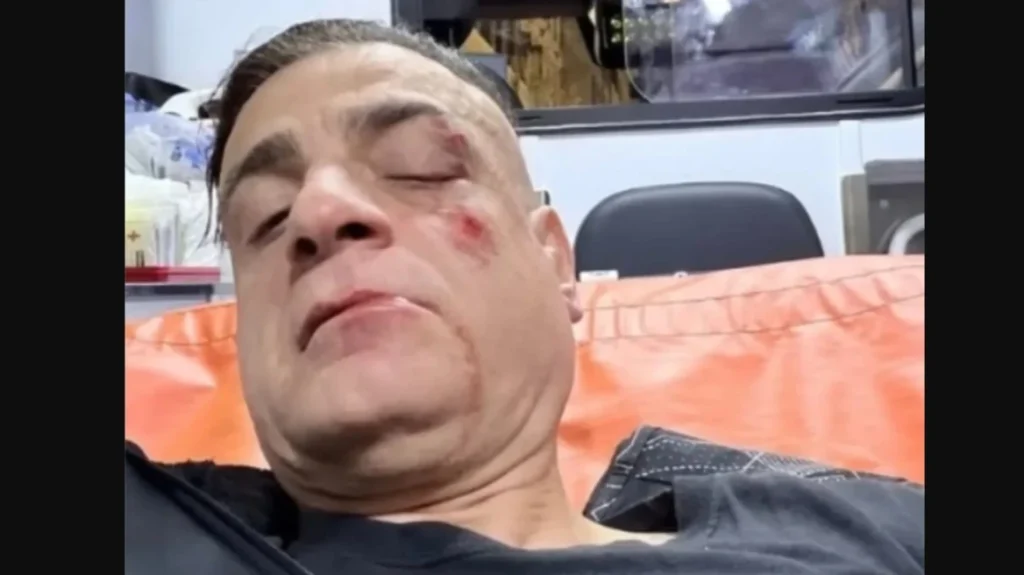 Ρώμη: Θύμα άγριου ξυλοδαρμού έπεσε Iταλός Youtuber σε σταθμό του μετρό από παράνομους μετανάστες (βίντεο)