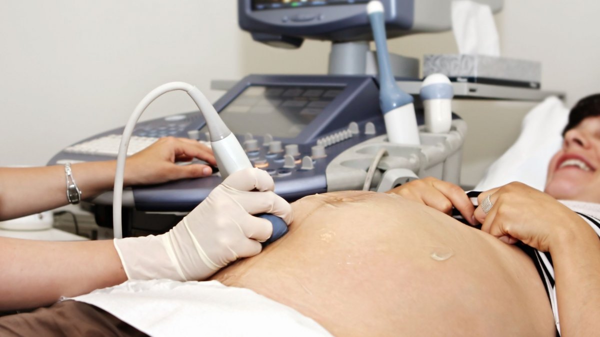 Αίγυπτος: Γυναίκα πήγε στον γιατρό για τακτικό υπερηχογράφημα και ανακάλυψε πως κυοφορούσε εννέα έμβρυα!