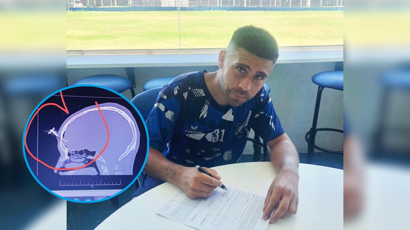 Άγρια συμπλοκή σε ποδοσφαιρικό παιχνίδι Κ-16 στην Αργεντινή: Κάρφωσαν κλειδί στο μέτωπο πατέρα! (βίντεο)