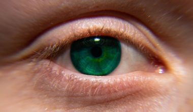 Κερατόκωνος: Tι είναι η πάθηση από την οποία πάσχει η Φαίη Σκορδά; – Τα συμπτώματα και από τι προκαλείται