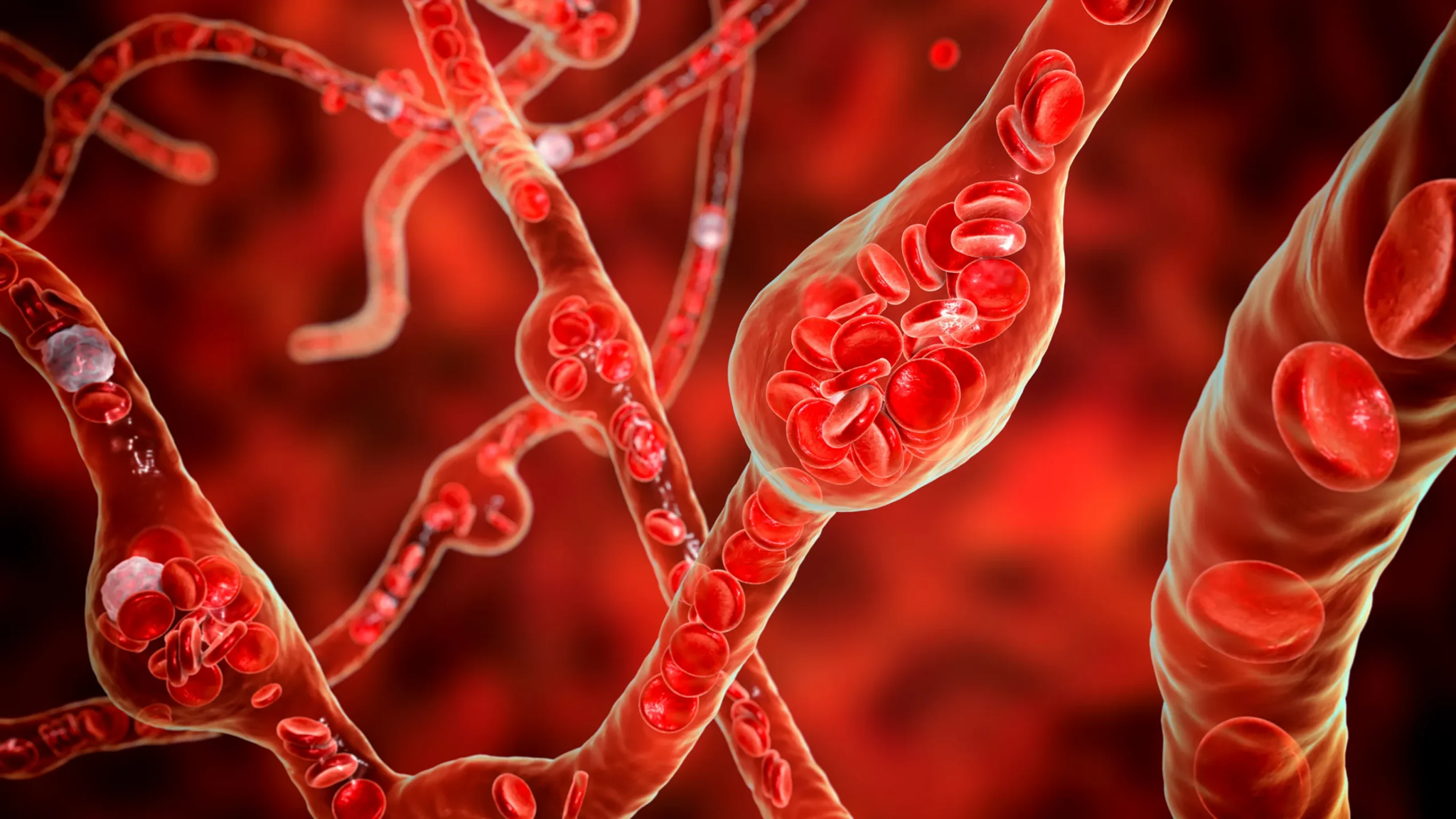 Ανεύρυσμα: Δείτε ποια είναι τα συμπτώματα αναλόγως σε ποιο σημείο εμφανίζεται