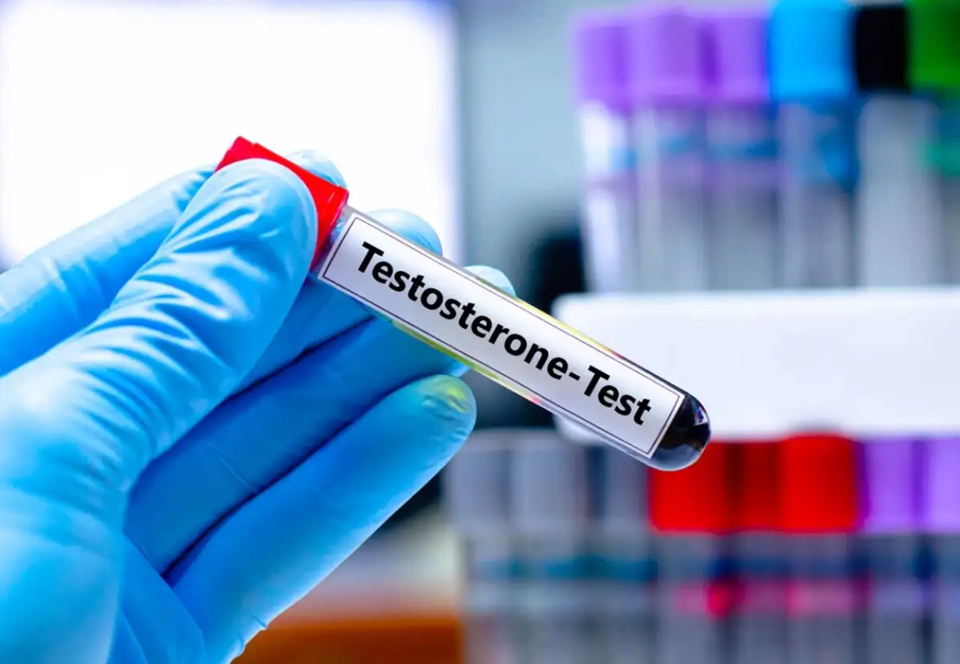 Υψηλή τεστοστερόνη στις γυναίκες: Αυτές είναι οι εννέα αιτίες – Τι προκαλεί