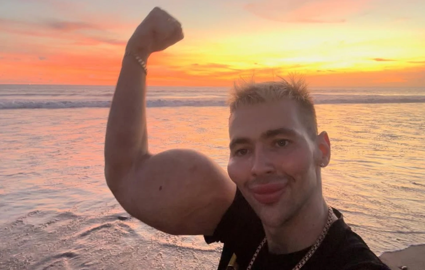 Ο Ρώσος «Ποπάι» κινδυνεύει να χάσει τα χέρια του από μόλυνση: Έκανε ενέσεις με βαζελίνη για να μεγαλώσουν! (βίντεο)